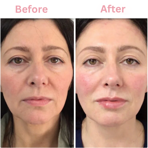 Bio-Glow Collagen Mask