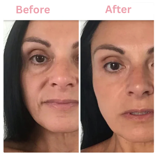 Bio-Glow Collagen Mask